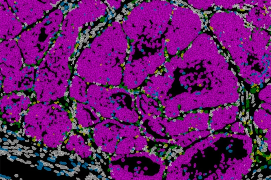 Ilustración científica que representa células cancerosas y el concepto de metástasis, con destaque en la regulación genética.