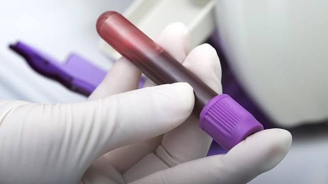 Análisis de sangre en laboratorio para diagnóstico de enfermedad de von Willebrand